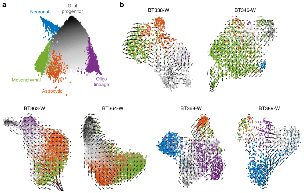 膠質母細胞瘤RNA速度分析 膠質母細胞瘤RNA速度分析