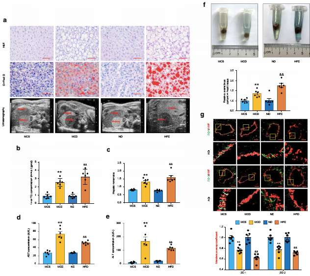NAFLD小鼠冠狀動脈微血管內皮通透性增強