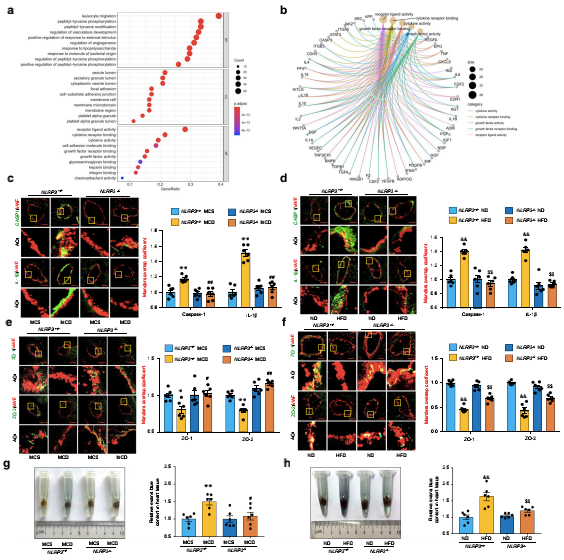 NLRP3炎癥小體介導NAFLD小鼠冠狀動脈微血管內皮高通透性