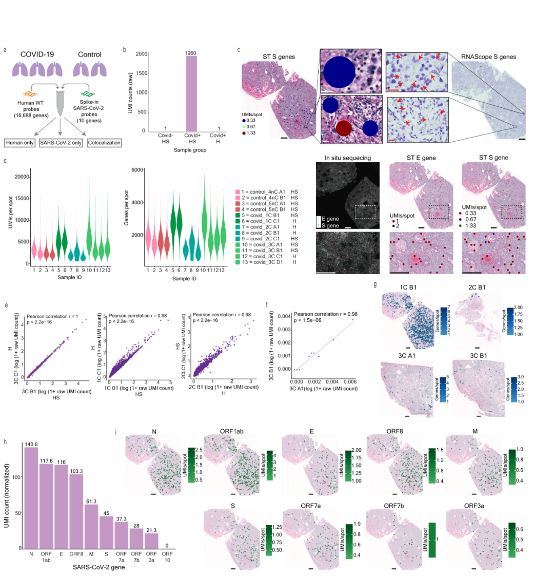 FFPE空間轉錄組解析人肺感染SARS-CoV-2 空間共定位新機制[2]