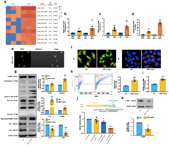 NAFLD肝源性外泌體通過激活組織蛋白酶B/NLRP3免疫激酶體軸誘導微血管內皮細胞高通透性